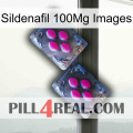 Sildenafil 100Mg Images 01